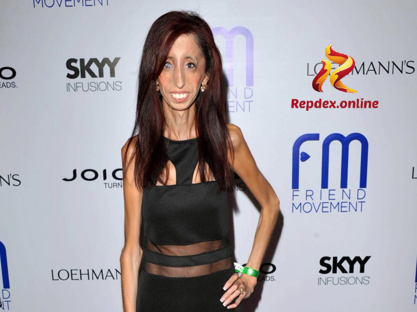 Lizzie Velasquez skinniest person alive 1